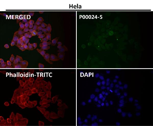1 - Anti-Phospho-Akt (Ser473) AKT1 Rabbit Monoclonal Antibody ABO13175