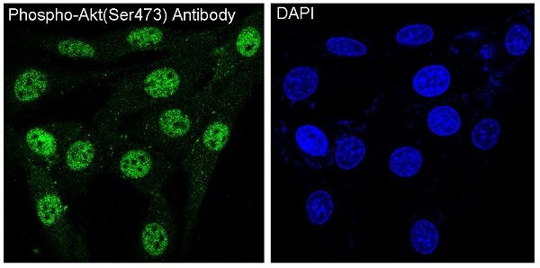 3 - Anti-Phospho-Akt (Ser473) AKT1 Rabbit Monoclonal Antibody ABO13175