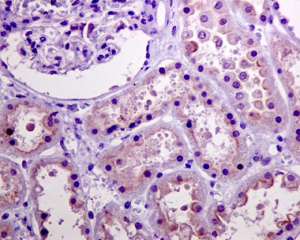 2 - Anti-Phospho-Akt (Ser473) AKT1 Rabbit Monoclonal Antibody ABO13175