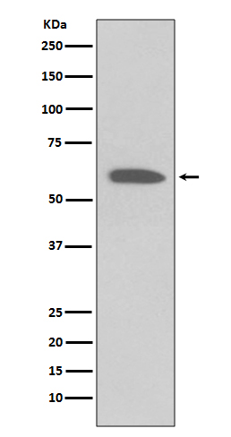1 - Anti-Phospho-Akt (Ser473) AKT1 Rabbit Monoclonal Antibody ABO13175