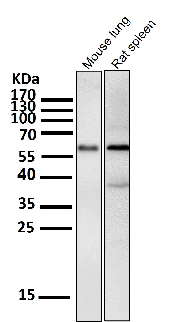 1 - Anti-Phospho-Akt (Ser473) AKT1 Rabbit Monoclonal Antibody ABO13175