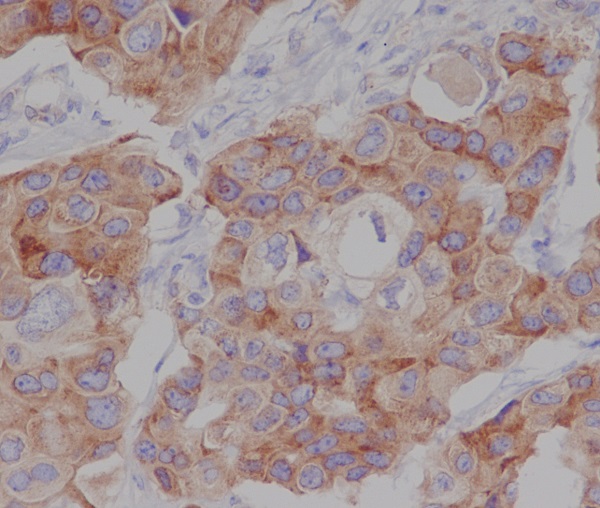 2 - Anti-Phospho-mTOR (S2448) Rabbit Monoclonal Antibody ABO13176