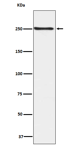 1 - Anti-Phospho-mTOR (S2448) Rabbit Monoclonal Antibody ABO13176