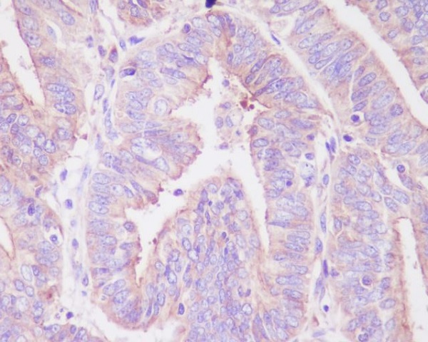 2 - Anti-Phospho-FoxO3a (S253) Rabbit Monoclonal Antibody ABO13177