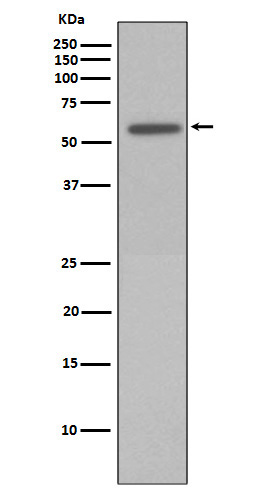 1 - Anti-Phospho-Vimentin (S72) Rabbit Monoclonal Antibody ABO13178