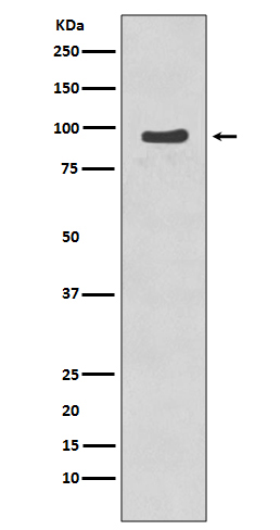 1 - Anti-Phospho-p95/NBS1 (S343) NBN Rabbit Monoclonal Antibody ABO13180
