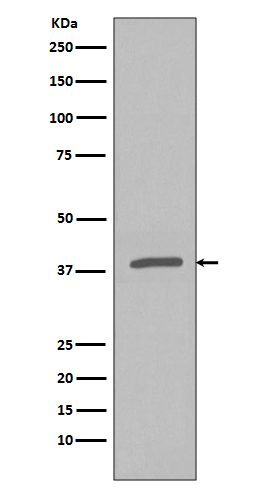 1 - Anti-Phospho-IKB alpha (S32) NFKBIA Rabbit Monoclonal Antibody ABO13181