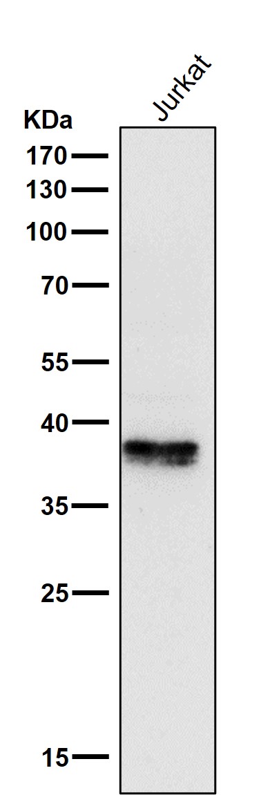 1 - Anti-Phospho-IKB alpha (S32) NFKBIA Rabbit Monoclonal Antibody ABO13181