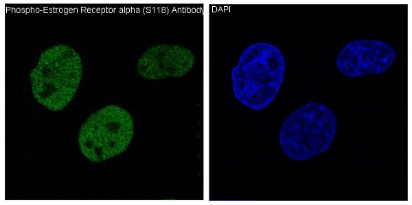3 - Anti-Phospho-ER alpha (S118) ESR1 Rabbit Monoclonal Antibody ABO13182