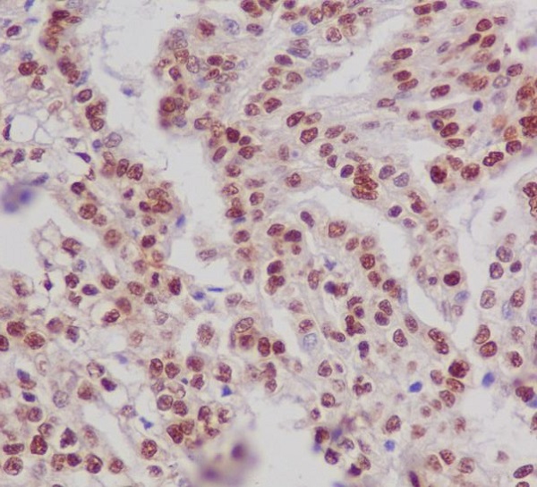 2 - Anti-Phospho-ER alpha (S118) ESR1 Rabbit Monoclonal Antibody ABO13182