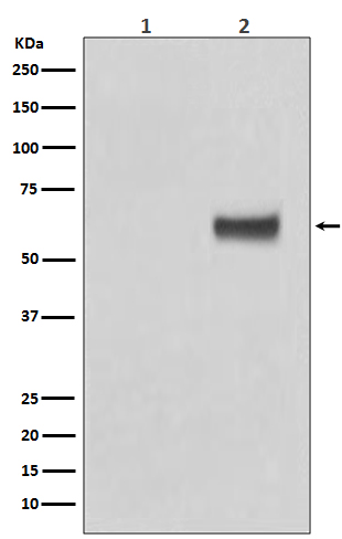 1 - Anti-Phospho-ER alpha (S118) ESR1 Rabbit Monoclonal Antibody ABO13182