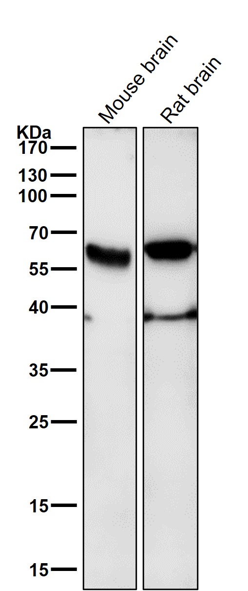 1 - Anti-Phospho-ER alpha (S118) ESR1 Rabbit Monoclonal Antibody ABO13182
