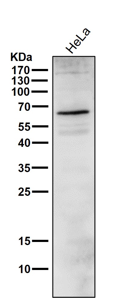 1 - Anti-Phospho-ER alpha (S118) ESR1 Rabbit Monoclonal Antibody ABO13182