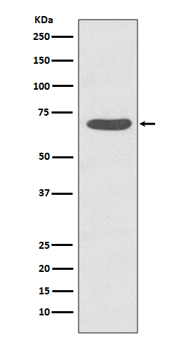 1 - Anti-Phospho-PKC zeta (T560) PRKCZ Rabbit Monoclonal Antibody ABO13183