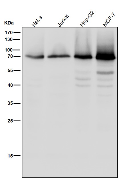 1 - Anti-Phospho-PKC zeta (T560) PRKCZ Rabbit Monoclonal Antibody ABO13183