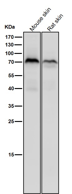 1 - Anti-Phospho-PKC zeta (T560) PRKCZ Rabbit Monoclonal Antibody ABO13183