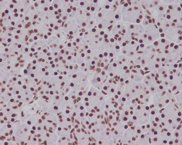 2 - Anti-Phospho-Smad5 (S463/465) Rabbit Monoclonal Antibody ABO13186