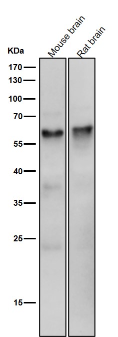 1 - Anti-Phospho-Smad5 (S463/465) Rabbit Monoclonal Antibody ABO13186