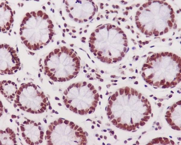 2 - Anti-Phospho-DNA PKcs (S2056) PRKDC Rabbit Monoclonal Antibody ABO13187