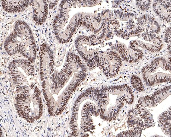 2 - Anti-Phospho-DNA PKcs (S2056) PRKDC Rabbit Monoclonal Antibody ABO13187