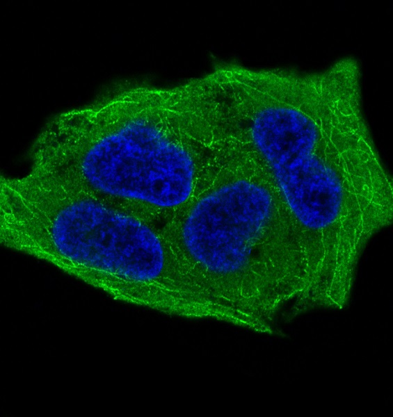 3 - Anti-Phospho-GSK3 beta (Ser9) Rabbit Monoclonal Antibody ABO13188