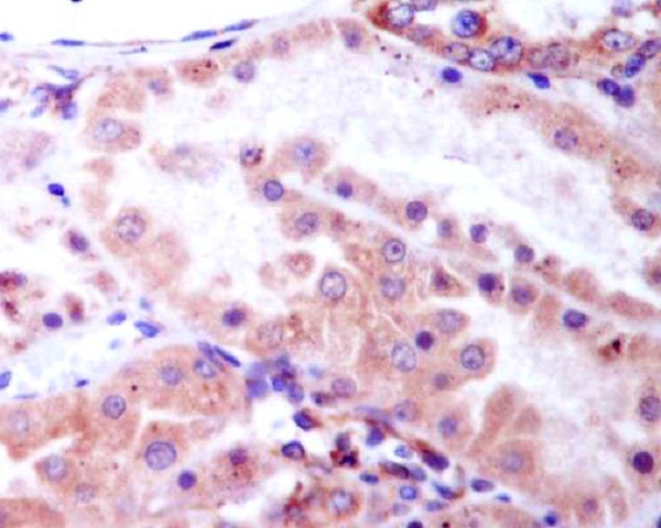 2 - Anti-Phospho-GSK3 beta (Ser9) Rabbit Monoclonal Antibody ABO13188