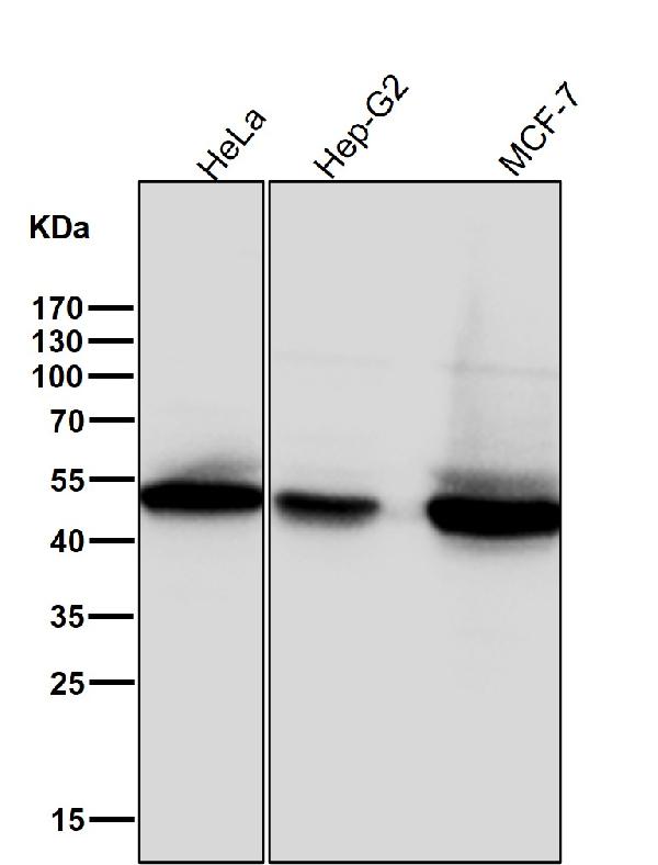 1 - Anti-Phospho-GSK3 beta (Ser9) Rabbit Monoclonal Antibody ABO13188