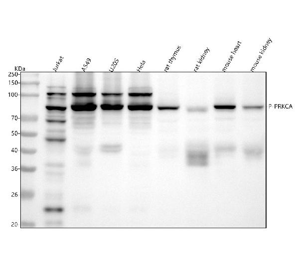1 - Anti-Phospho-PKC alpha (T638) PRKCA Rabbit Monoclonal Antibody ABO13189