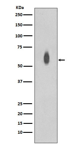 1 - Anti-Phospho-c-Myc (T58 + S62) Rabbit Monoclonal Antibody ABO13190