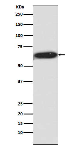 1 - Anti-Phospho-S6K1 (T421 + S424) RPS6KB1 Rabbit Monoclonal Antibody ABO13194