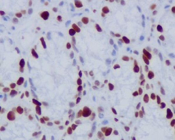 2 - Anti-Phospho-Histone H1.4 (T17) HIST1H1E Rabbit Monoclonal Antibody ABO13197