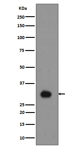 1 - Anti-Phospho-Histone H1.4 (T17) HIST1H1E Rabbit Monoclonal Antibody ABO13197