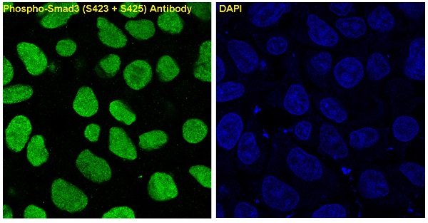 3 - Anti-Phospho-Smad3 (S423 + S425) Rabbit Monoclonal Antibody ABO13199
