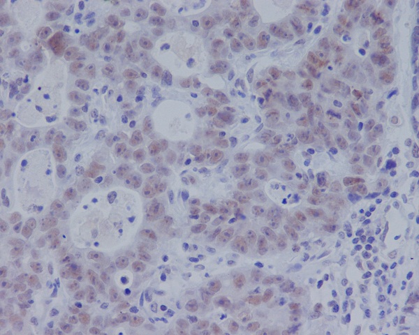 2 - Anti-Phospho-Smad3 (S423 + S425) Rabbit Monoclonal Antibody ABO13199