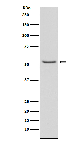 1 - Anti-Phospho-Smad3 (S423 + S425) Rabbit Monoclonal Antibody ABO13199