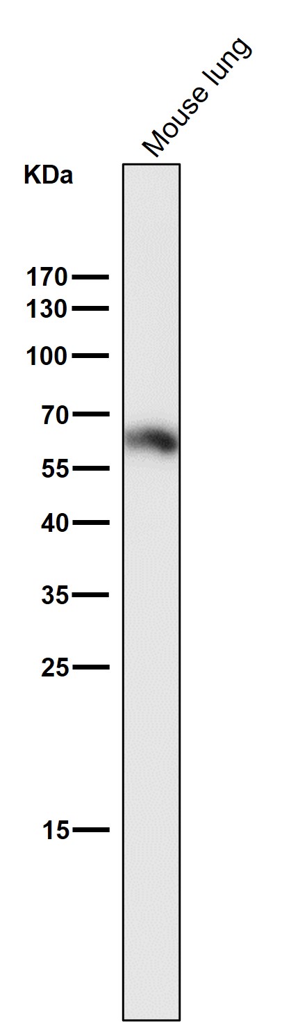 1 - Anti-Phospho-Smad3 (S423 + S425) Rabbit Monoclonal Antibody ABO13199