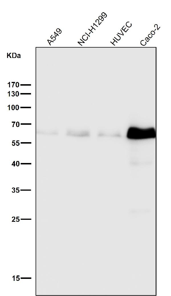1 - Anti-Phospho-Smad3 (S423 + S425) Rabbit Monoclonal Antibody ABO13199