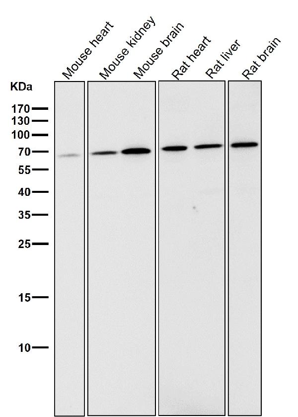1 - Anti-Phospho-AMPK alpha 2 (S345) PRKAA2 Rabbit Monoclonal Antibody ABO13202