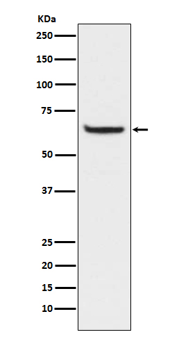1 - Anti-Phospho-NF-Kappa B p65 (S529) RELA Rabbit Monoclonal Antibody ABO13204