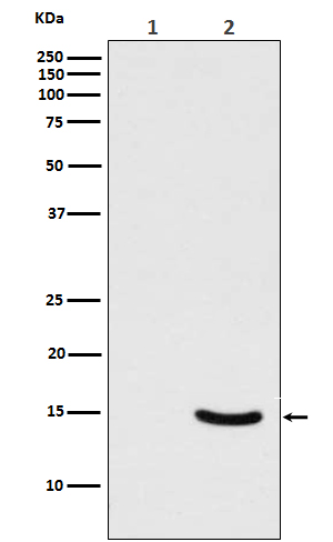 1 - Anti-Phospho-alpha Synuclein (S129) SNCA Rabbit Monoclonal Antibody ABO13205