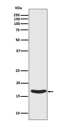 1 - Anti-Phospho-alpha Synuclein (S129) SNCA Rabbit Monoclonal Antibody ABO13206