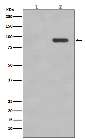 1 - Anti-Phospho-beta Catenin (S33/S37) CTNNB1 Rabbit Monoclonal Antibody ABO13207