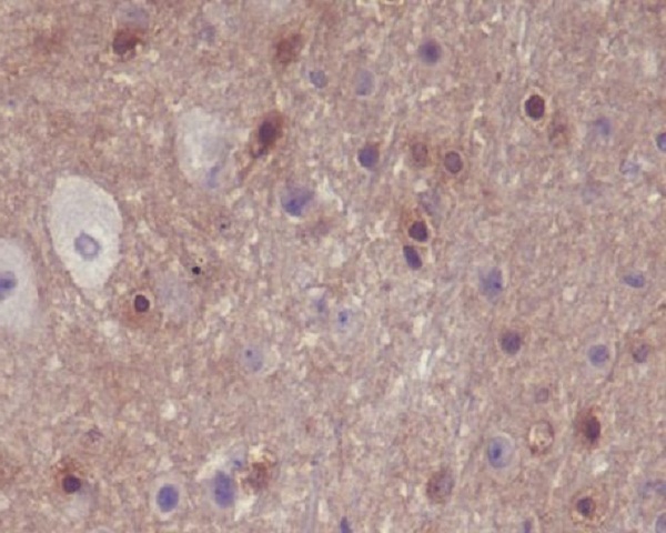 2 - Anti-Phospho-PAK1/2/3 (S144+S141+S139) PAK3 Rabbit Monoclonal Antibody ABO13208