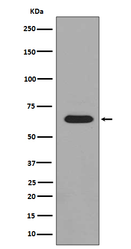 1 - Anti-Phospho-PAK1/2/3 (S144+S141+S139) PAK3 Rabbit Monoclonal Antibody ABO13208