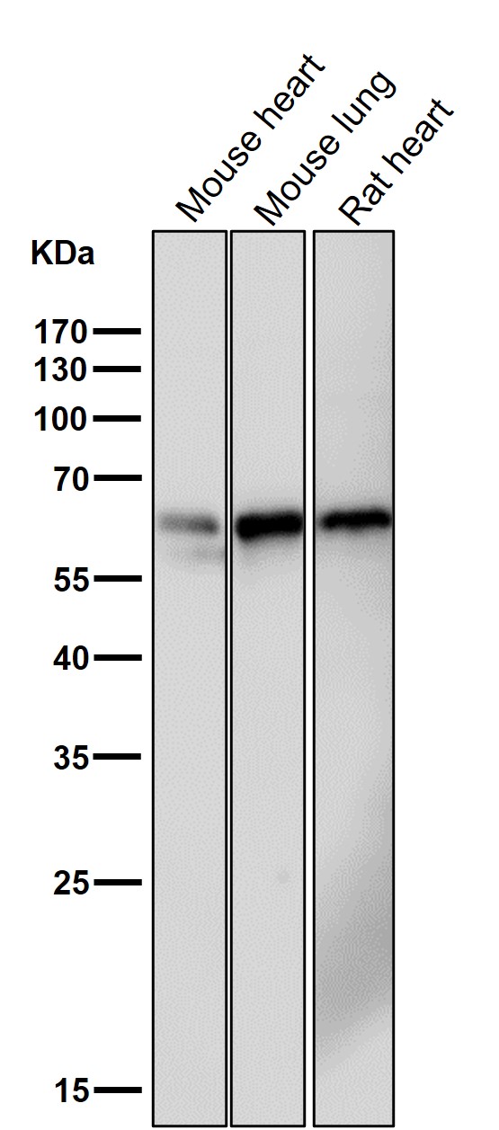 1 - Anti-Phospho-PAK1/2/3 (S144+S141+S139) PAK3 Rabbit Monoclonal Antibody ABO13208