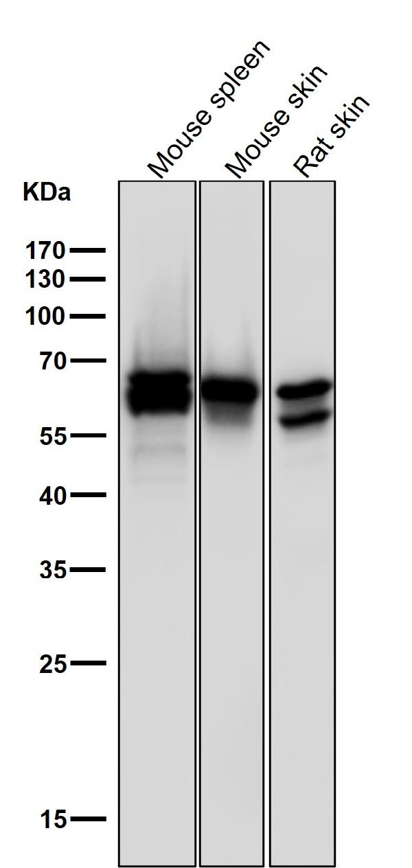 1 - Anti-Phospho-PAK1/2/3 (S144+S141+S139) PAK3 Rabbit Monoclonal Antibody ABO13208