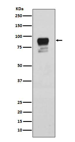 1 - Anti-Phospho-Glycogen synthase 1 (S641) GYS1 Rabbit Monoclonal Antibody ABO13210