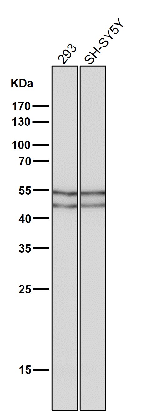 1 - Anti-Phospho-GSK3 (alpha + beta) (Y216 + Y279) GSK3A Rabbit Monoclonal Antibody ABO13211