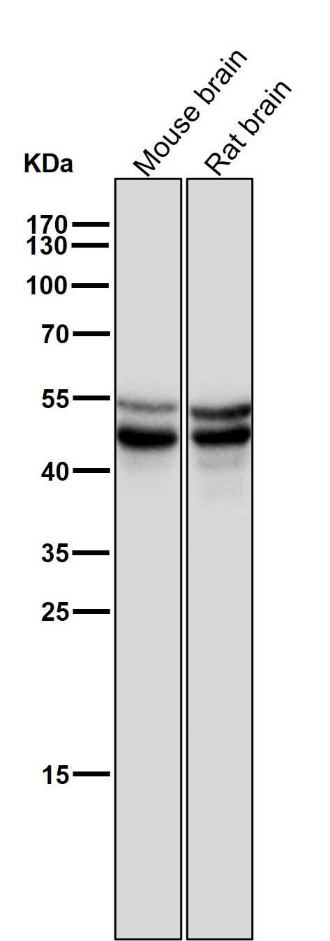 1 - Anti-Phospho-GSK3 (alpha + beta) (Y216 + Y279) GSK3A Rabbit Monoclonal Antibody ABO13211