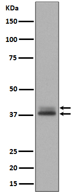 1 - Anti-Phospho-Erk1 (T202/Y204) + Erk2 (T185/Y187) MAPK3 Rabbit Monoclonal Antibody ABO13212